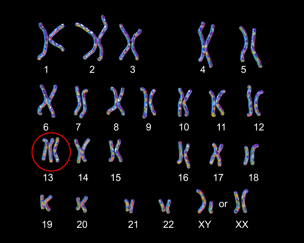 Patau-syndrome karyotype, labeled. Trisomy 13. 3D illustration