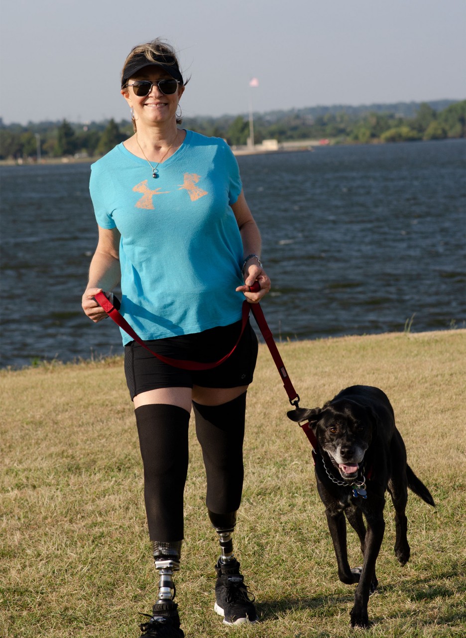 A woman with two lower leg prosthesis walks her dog at a lake.